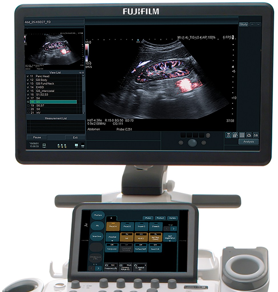 Imagem ilustrativa de Equipamento de ultrassom portátil