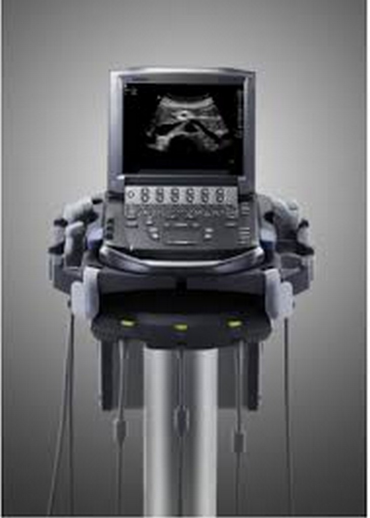 Imagem ilustrativa de Locação de equipamento de ultrassom portátil