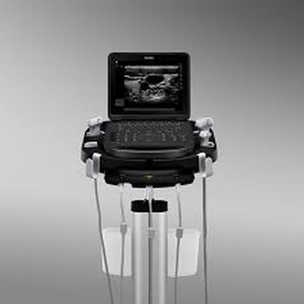 Imagem ilustrativa de Sonosite m turbo